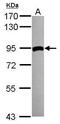 Transglutaminase 2 antibody, GTX111701, GeneTex, Western Blot image 