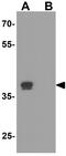 Kruppel Like Factor 17 antibody, GTX31603, GeneTex, Western Blot image 