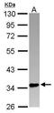 PIN2 (TERF1) Interacting Telomerase Inhibitor 1 antibody, GTX116274, GeneTex, Western Blot image 
