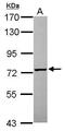Phosphoglucomutase 2 antibody, GTX119169, GeneTex, Western Blot image 