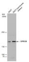 Adhesion G Protein-Coupled Receptor G6 antibody, GTX129821, GeneTex, Western Blot image 