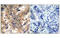 Phosphatidylinositol-3-kinase antibody, MBS835398, MyBioSource, Immunohistochemistry paraffin image 
