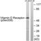 Vitamin D Receptor antibody, TA313343, Origene, Western Blot image 