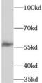 Tryptophan Hydroxylase 2 antibody, FNab08885, FineTest, Western Blot image 