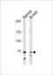 Toll Like Receptor Adaptor Molecule 1 antibody, LS-C203948, Lifespan Biosciences, Western Blot image 