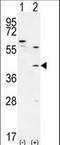 TGIF1 antibody, LS-C161833, Lifespan Biosciences, Western Blot image 