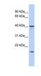 SLAIN Motif Family Member 1 antibody, NBP1-70704, Novus Biologicals, Western Blot image 