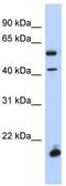 Developing Brain Homeobox 1 antibody, TA339648, Origene, Western Blot image 