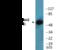 AKT Serine/Threonine Kinase 2 antibody, EKC2348, Boster Biological Technology, Western Blot image 