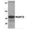 Sirtuin 5 antibody, MBS150531, MyBioSource, Western Blot image 