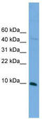 BolA Family Member 2B antibody, TA329608, Origene, Western Blot image 