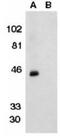 C-X-C Motif Chemokine Receptor 6 antibody, GTX74372, GeneTex, Western Blot image 