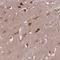 Gamma-Aminobutyric Acid Type A Receptor Beta1 Subunit antibody, HPA051297, Atlas Antibodies, Immunohistochemistry paraffin image 