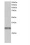 Tripartite Motif Containing 7 antibody, NB100-1229, Novus Biologicals, Western Blot image 