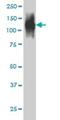 FAP antibody, H00002191-M01, Novus Biologicals, Western Blot image 