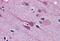 Gastrulation Brain Homeobox 2 antibody, MBS246906, MyBioSource, Immunohistochemistry paraffin image 