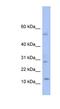 Putative TLX1 neighbor protein antibody, NBP1-70721, Novus Biologicals, Western Blot image 