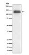 Nuclear Factor Of Activated T Cells 2 antibody, M00969, Boster Biological Technology, Western Blot image 