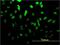 Transcription Factor 4 antibody, H00006925-M01, Novus Biologicals, Immunofluorescence image 