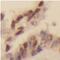 Mitogen-Activated Protein Kinase Kinase 7 antibody, FNab10158, FineTest, Immunohistochemistry paraffin image 