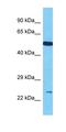 Uncharacterized protein C17orf51 antibody, orb326902, Biorbyt, Western Blot image 