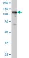 Tyrosine Kinase 2 antibody, H00007297-M02, Novus Biologicals, Western Blot image 