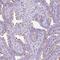 Transmembrane Protein 89 antibody, PA5-62811, Invitrogen Antibodies, Immunohistochemistry frozen image 