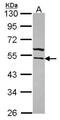 Tryptophanyl-TRNA Synthetase antibody, NBP2-20744, Novus Biologicals, Western Blot image 