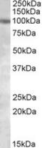 Polycystin 2, Transient Receptor Potential Cation Channel antibody, LS-C108143, Lifespan Biosciences, Western Blot image 