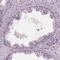 ADP-Ribosylhydrolase Like 1 antibody, HPA066478, Atlas Antibodies, Immunohistochemistry frozen image 