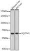 Sequestosome 1 antibody, LS-C746920, Lifespan Biosciences, Western Blot image 