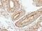 Eukaryotic Translation Initiation Factor 2B Subunit Beta antibody, PA5-22295, Invitrogen Antibodies, Immunohistochemistry paraffin image 