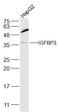 Insulin Like Growth Factor Binding Protein 3 antibody, GTX02574, GeneTex, Western Blot image 