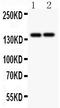 Collagen Type III Alpha 1 Chain antibody, LS-C357443, Lifespan Biosciences, Western Blot image 