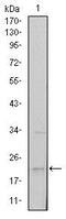 Snail Family Transcriptional Repressor 1 antibody, MA5-15791, Invitrogen Antibodies, Western Blot image 