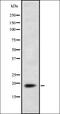 Myosin Light Chain 2 antibody, orb336919, Biorbyt, Western Blot image 