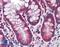 Caspase 8 antibody, LS-B3797, Lifespan Biosciences, Immunohistochemistry paraffin image 