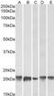 Ferritin Light Chain antibody, MBS422205, MyBioSource, Western Blot image 