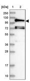Huntingtin Interacting Protein 1 Related antibody, PA5-58261, Invitrogen Antibodies, Western Blot image 
