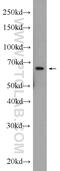HECT Domain And Ankyrin Repeat Containing E3 Ubiquitin Protein Ligase 1 antibody, 24104-1-AP, Proteintech Group, Western Blot image 