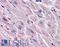 Endothelin Receptor Type A antibody, LS-A4072, Lifespan Biosciences, Immunohistochemistry paraffin image 