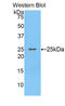 Osteoclast Stimulating Factor 1 antibody, LS-C295730, Lifespan Biosciences, Western Blot image 