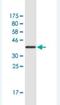 Lysine Methyltransferase 2D antibody, H00008085-M01, Novus Biologicals, Western Blot image 