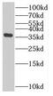 Solute Carrier Family 25 Member 33 antibody, FNab07940, FineTest, Western Blot image 