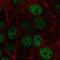 Zinc Fingers And Homeoboxes 1 antibody, HPA060251, Atlas Antibodies, Immunofluorescence image 