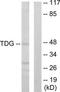 Thymine DNA Glycosylase antibody, TA314606, Origene, Western Blot image 