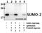 Small Ubiquitin Like Modifier 2 antibody, GTX66829, GeneTex, Immunoprecipitation image 