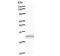 Aryl Hydrocarbon Receptor antibody, LS-C342813, Lifespan Biosciences, Western Blot image 
