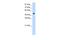 RNA Binding Motif Protein 45 antibody, PA5-41951, Invitrogen Antibodies, Western Blot image 