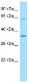 Interleukin 4 Induced 1 antibody, TA337862, Origene, Western Blot image 